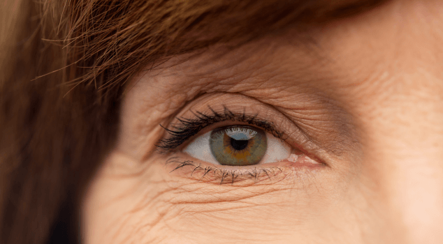 Halo42 Eye Wrinkles